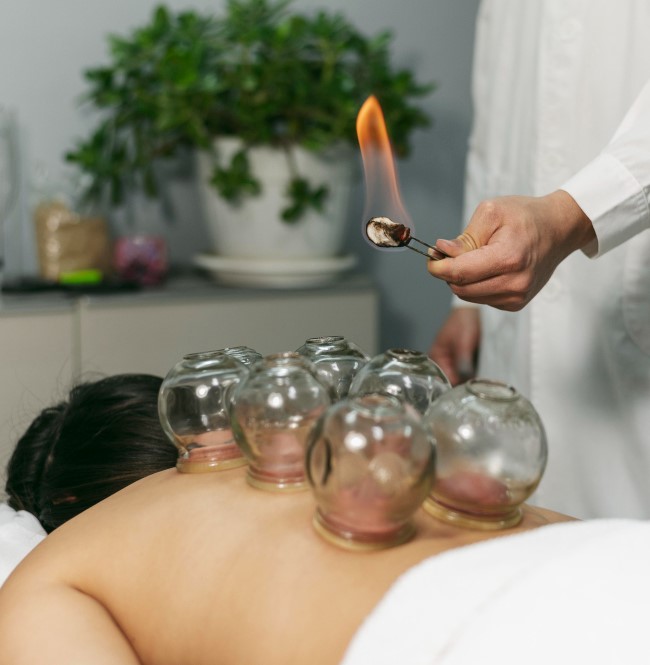 Ilustracja sekcji usług baniek ogniowych